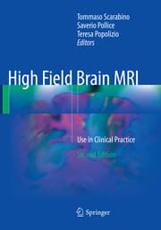 Cover von High Field Brain MRI