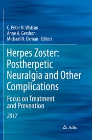 Cover von Herpes Zoster: Postherpetic Neuralgia and Other Complications