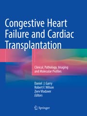 Cover von Congestive Heart Failure and Cardiac Transplantation