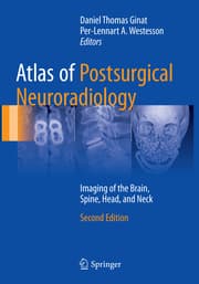 Cover von Atlas of Postsurgical Neuroradiology