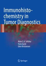 Cover von Immunohistochemistry in Tumor Diagnostics