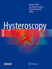 Cover von Hysteroscopy