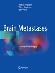 Cover von Brain Metastases
