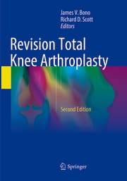 Cover von Revision Total Knee Arthroplasty