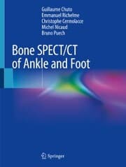 Cover von Bone SPECT/CT of Ankle and Foot