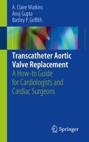 Cover von Transcatheter Aortic Valve Replacement