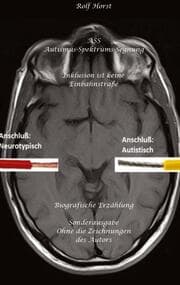 Cover von ASS Autismus-Spektrums-Segnung - Inklusion ist keine Einbahnstraße: hochfunktionaler Autismus, Mobbing, Trauma, Sucht, Häusliche Gewalt, Psychotherapie, Umzug, Inklusion, Katholische Kirche, Zen