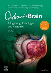 Cover von Osborn's Brain