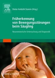 Cover von Früherkennung von Bewegungsstörungen beim Säugling