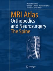 Cover von MRI Atlas