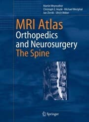 Cover von MRI Atlas