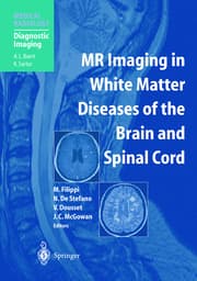 Cover von MR Imaging in White Matter Diseases of the Brain and Spinal Cord