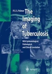 Cover von The Imaging of Tuberculosis