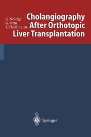 Cover von Cholangiography After Orthotopic Liver Transplantation