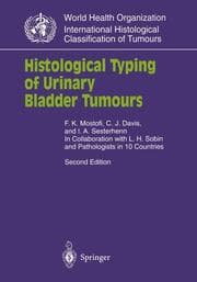 Cover von Histological Typing of Urinary Bladder Tumours