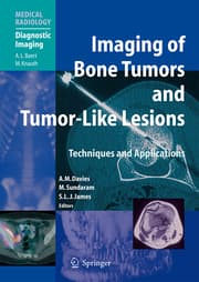 Cover von Imaging of Bone Tumors and Tumor-Like Lesions