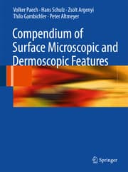 Cover von Compendium of Surface Microscopic and Dermoscopic Features