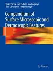 Cover von Compendium of Surface Microscopic and Dermoscopic Features