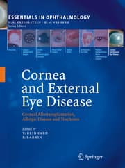 Cover von Cornea and External Eye Disease