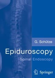 Cover von Epiduroscopy