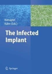 Cover von The Infected Implant