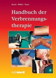 Cover von Handbuch der Verbrennungstherapie