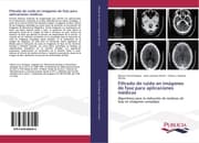 Cover von Filtrado de ruido en imágenes de fase para aplicaciones médicas