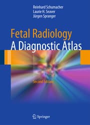 Cover von Fetal Radiology