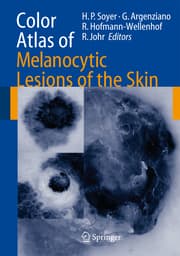 Cover von Color Atlas of Melanocytic Lesions of the Skin