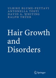 Cover von Hair Growth and Disorders
