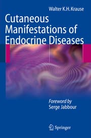 Cover von Cutaneous Manifestations of Endocrine Diseases
