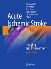Cover von Acute Ischemic Stroke