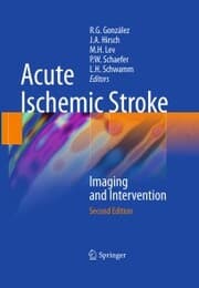 Cover von Acute Ischemic Stroke