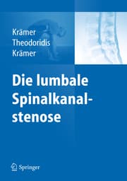 Cover von Die lumbale Spinalkanalstenose