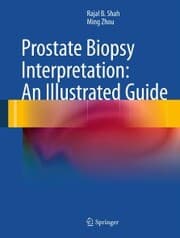 Cover von Prostate Biopsy Interpretation: An Illustrated Guide