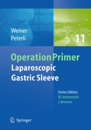 Cover von Laparoscopic Gastric Sleeve
