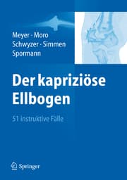 Cover von Der kapriziöse Ellbogen