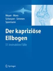 Cover von Der kapriziöse Ellbogen