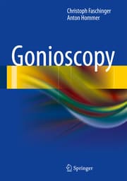 Cover von Gonioscopy