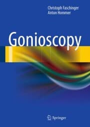 Cover von Gonioscopy