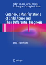 Cover von Cutaneous Manifestations of Child Abuse and Their Differential Diagnosis