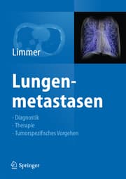 Cover von Lungenmetastasen