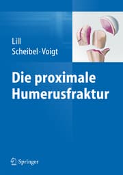 Cover von Die proximale Humerusfraktur