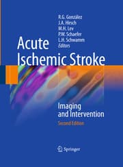 Cover von Acute Ischemic Stroke