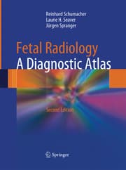 Cover von Fetal Radiology