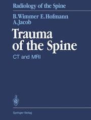 Cover von Trauma of the Spine