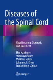 Cover von Diseases of the Spinal Cord