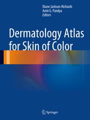 Cover von Dermatology Atlas for Skin of Color