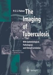 Cover von The Imaging of Tuberculosis