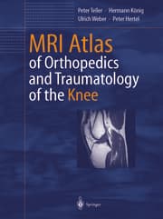 Cover von MRI Atlas of Orthopedics and Traumatology of the Knee
